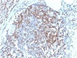 CD6 Antibody (C6/2884R) - Azide and BSA Free, Novus Biologicals 100 &mu;g | Buy Online | Novus Biologicals | Fisher Scientific